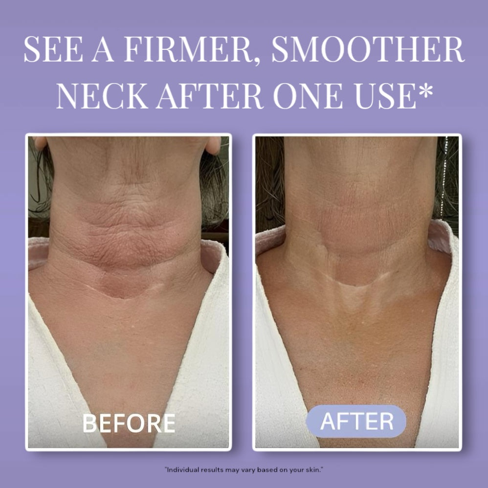 LUMERA™ Neck Cream