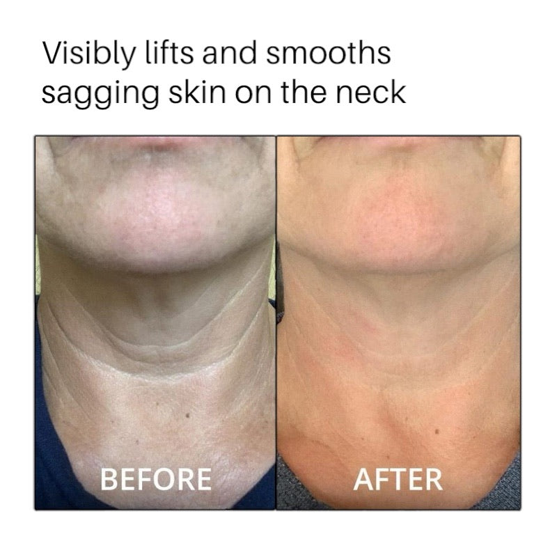LUMERA™ Neck Cream