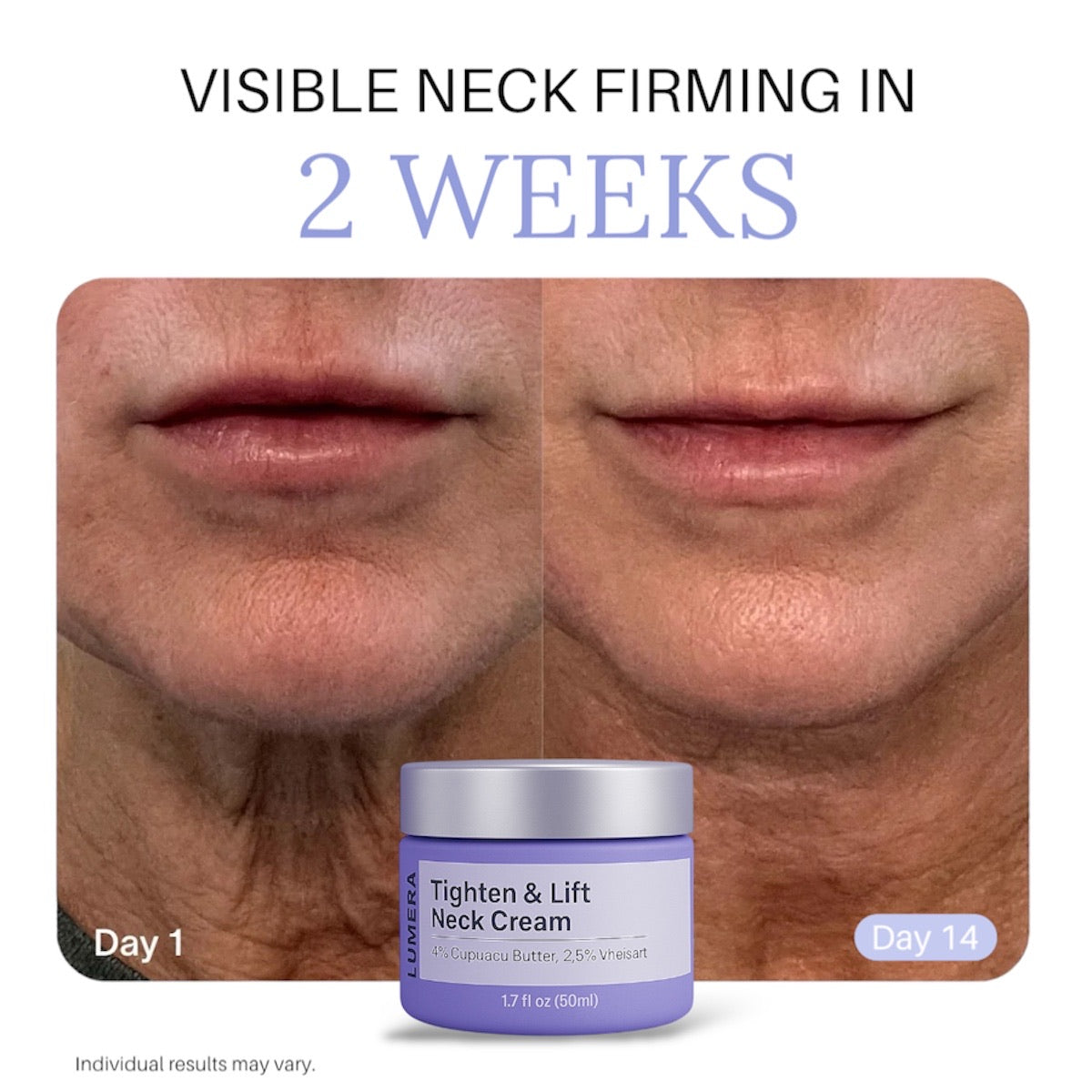 LUMERA™ Neck Cream