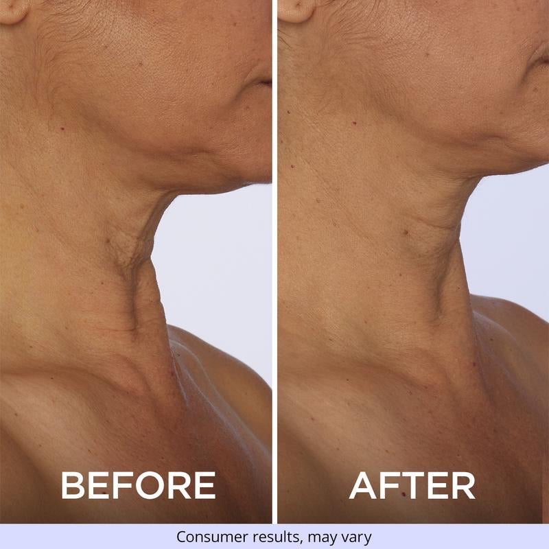 LUMERA™ Neck Cream